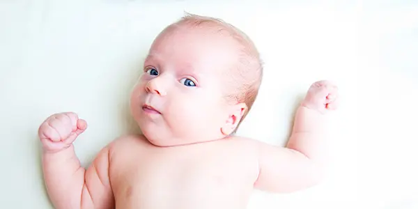 baby with Torticollis laying on white background